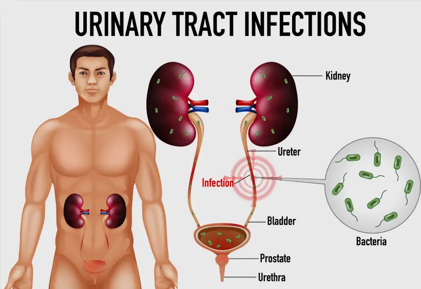 Department of Urology Hospital Rajpura