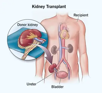 Kidney