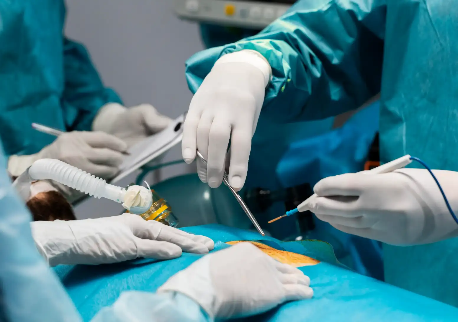Laparoscopic surgery being performed by surgeon using advanced medical equipment