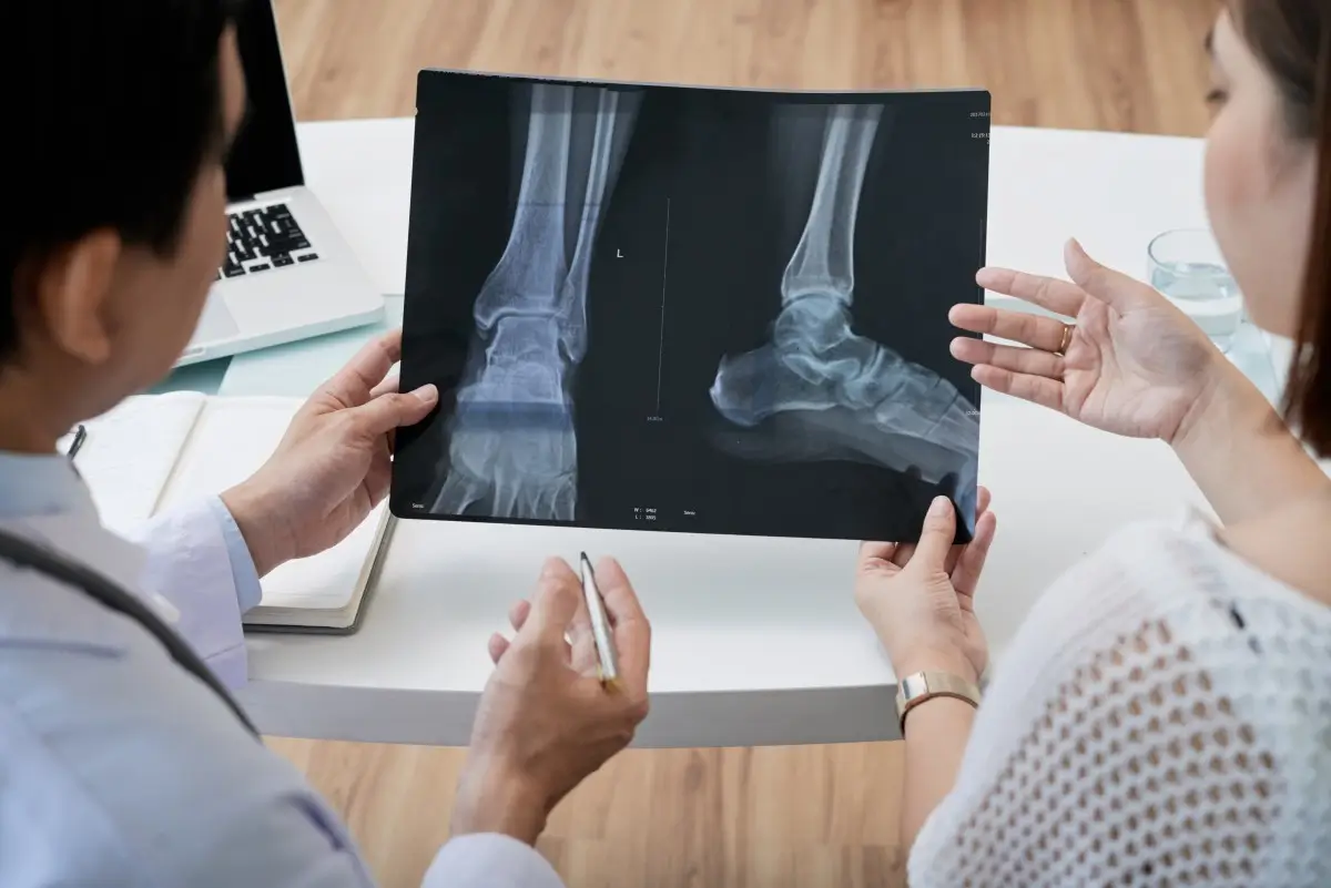 Bone Fracture Pain Relief-Treatment
